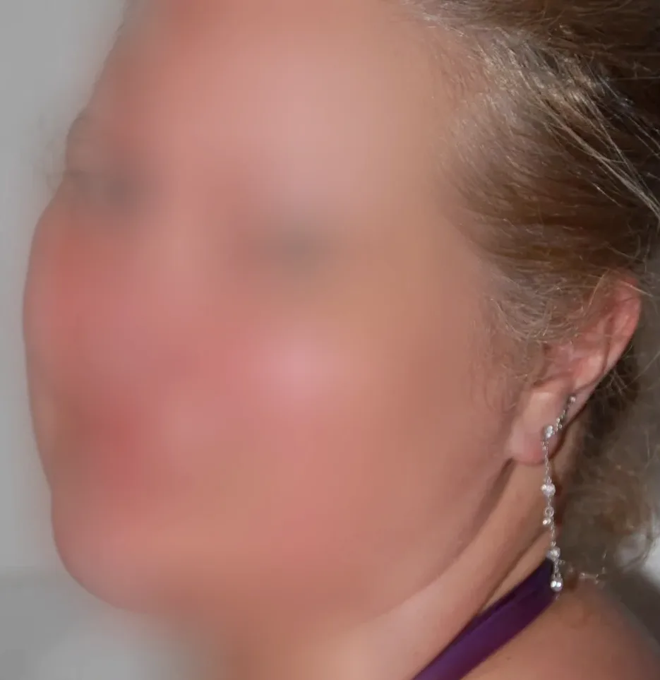 Salla, 28